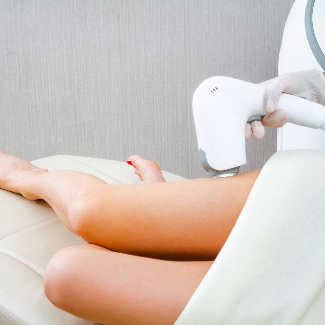 laser hair removal small